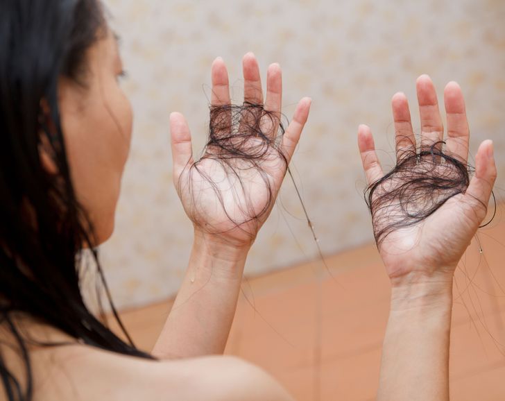 Causes of Hair Loss, and 7 Ways to Tell If You're Losing Too Much ...