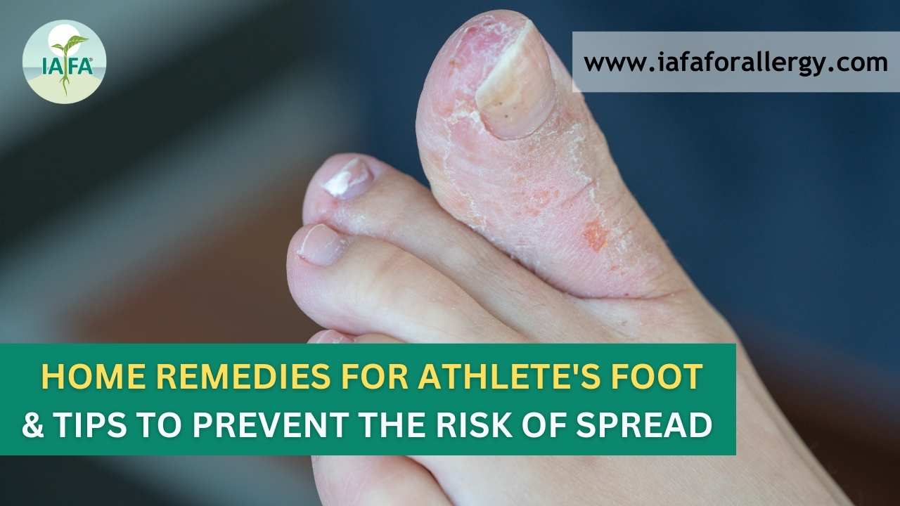 10 Home Remedies for Athlete's Foot | Tips to Prevent the Risk of ...
